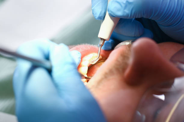 Best Weekend Emergency Dentist in Salisbury, MO