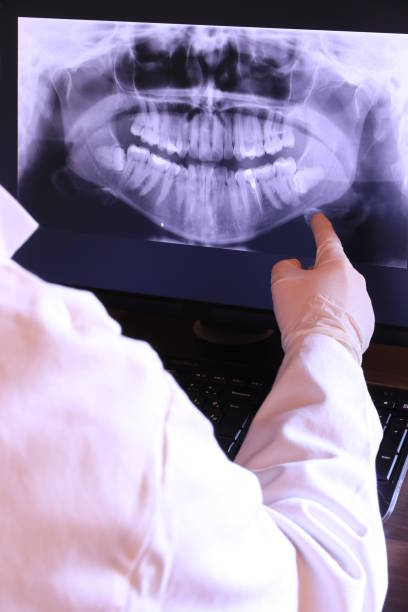 Best Emergency Tooth Extraction in Salisbury, MO