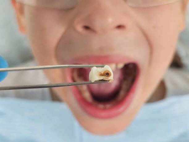 Best Emergency TMJ Treatment in Salisbury, MO